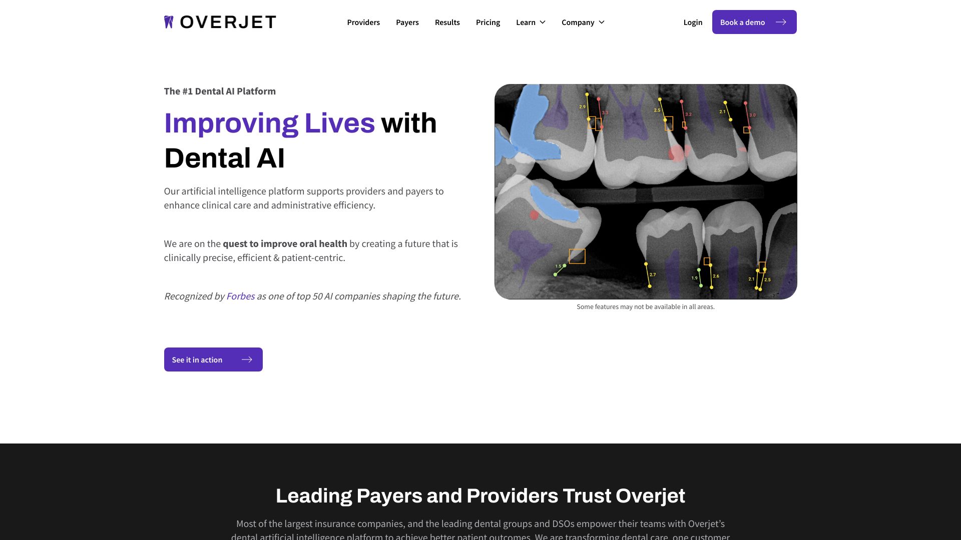 Overjet AI